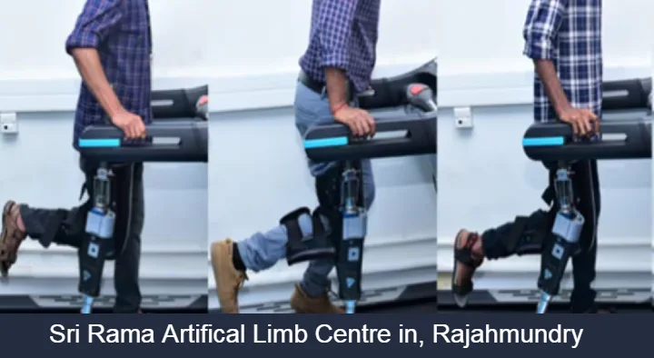 Aritificial Limbs in Rajahmundry (Rajamahendravaram) : Sri Rama Artifical Limb Centre in Tadithota