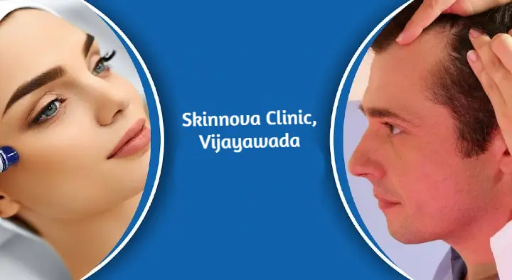 Skin And Hair Treatment Clinic in Vijayawada (Bezawada) : Skinnova Clinic in Venkateswara Nagar