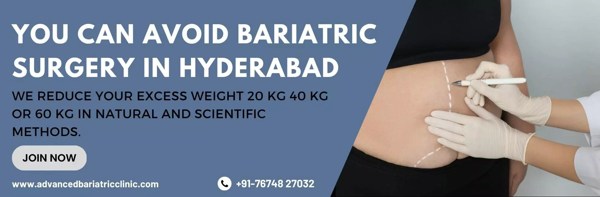Photos Hyderabad 672023101408 ss diabetes obesity clinic miyapur in hyderabad 6.webp