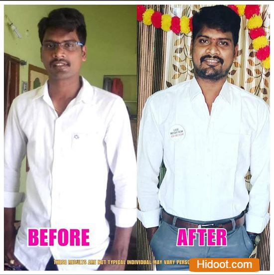 happy wellness center sree nagar in kakinada - Photo No.9