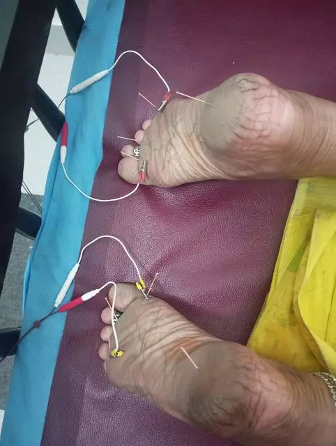 srinidhi physiotherapy and acupunture sarpavaram in kakinada - Photo No.2