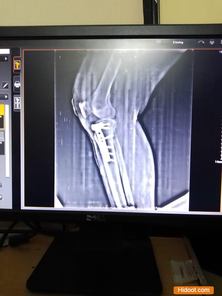 vijayawada home care service currecy nagar in vijayawada ap - Photo No.7