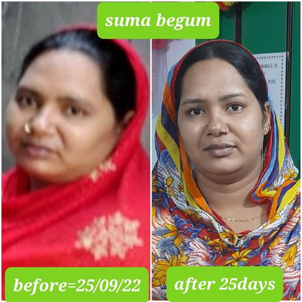 weight loss and nutrition center phool bagh in vizianagaram - Photo No.9