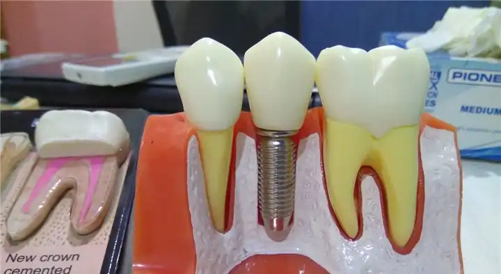 Your Dentist Dental Clinic in Ashok Nagar, Vijayawada