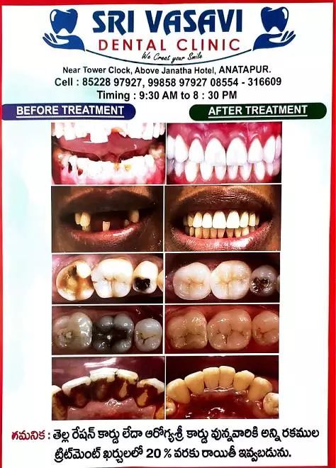 Sri Vasavi Dental Clinic Gulzarpet Anantapur - Photo No. 31