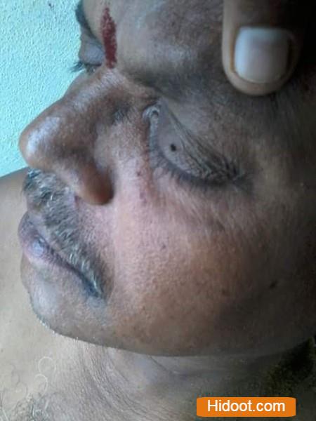 Lakshmi Mulika Vaidyasala Near In Lala Peta Guntur District - Photo No. 41