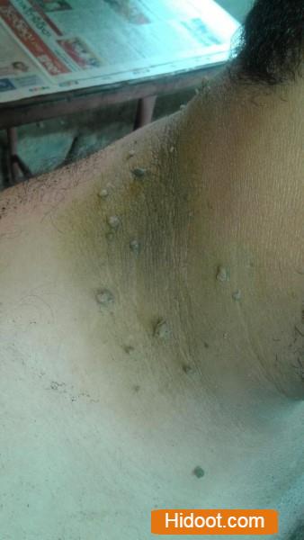 Lakshmi Mulika Vaidyasala Near In Lala Peta Guntur District - Photo No. 31