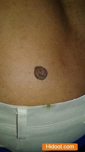 Lakshmi Mulika Vaidyasala Near In Lala Peta Guntur District - Photo No. 21