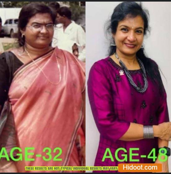 Happy Wellness Center Sree Nagar In Kakinada - Photo No. 41