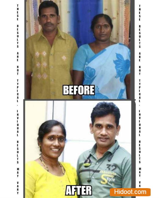 Happy Wellness Center Sree Nagar In Kakinada - Photo No. 31