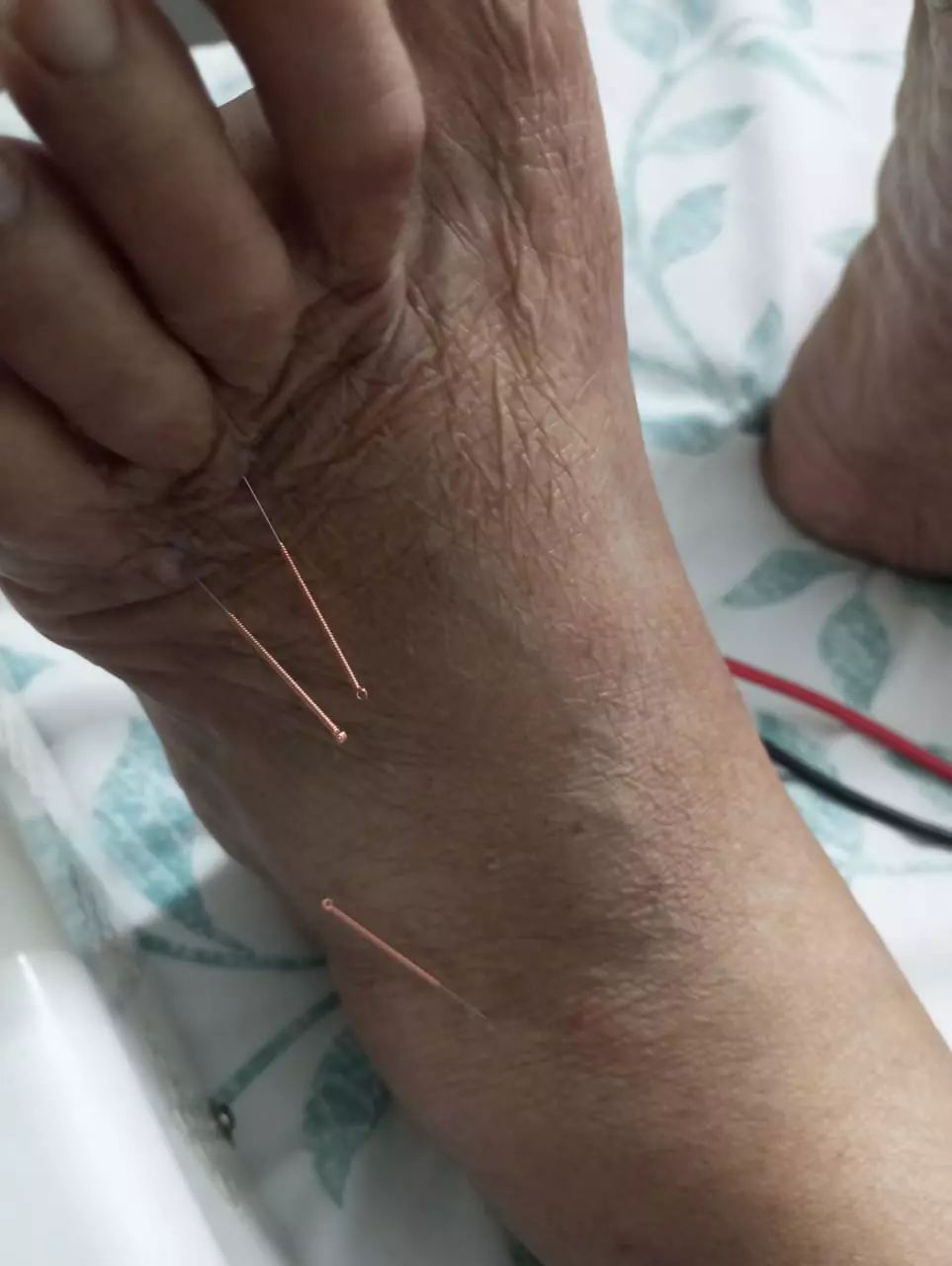 Srinidhi Physiotherapy And Acupunture Sarpavaram In Kakinada - Photo No. 71