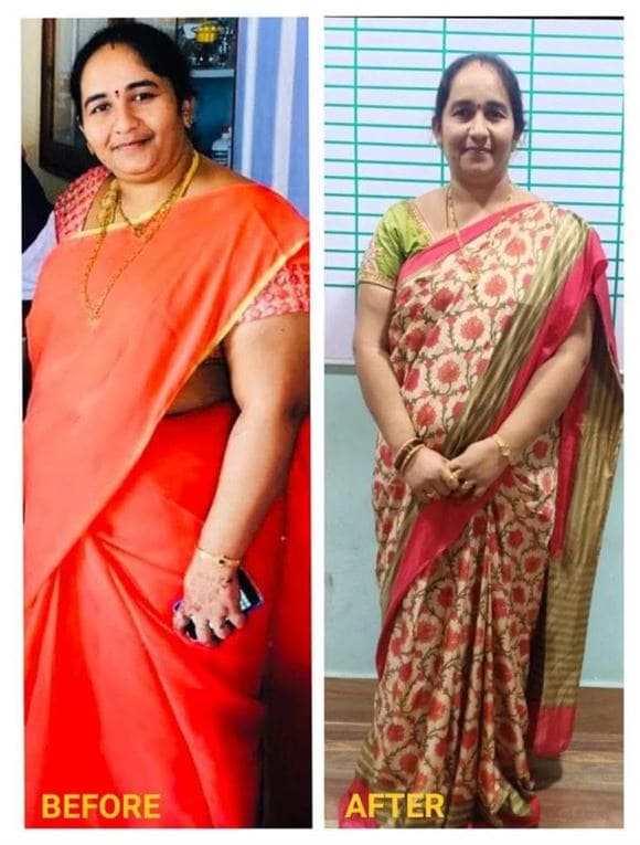 siva wellness world mogalrajpuram in vijayawada - Photo No.30